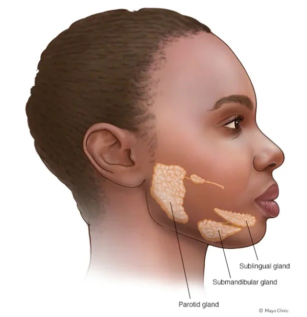 متلازمة شوغرن (Sjogren's syndrome)