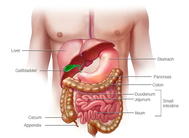 داء كرون أو كرونز (Crohn's disease)