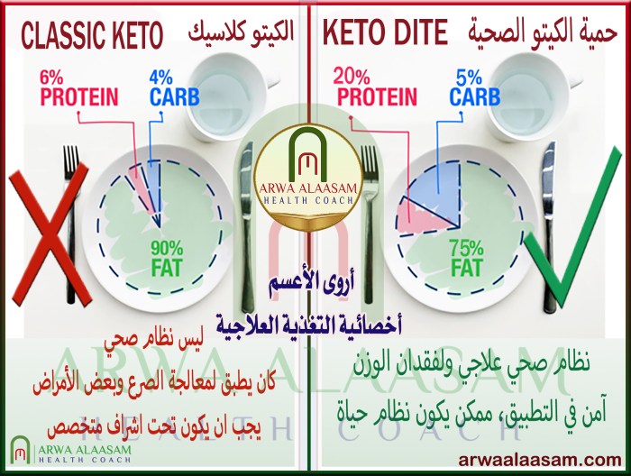 الكيتو كلاسيك نظام ممنوع تطبيقه صحياً